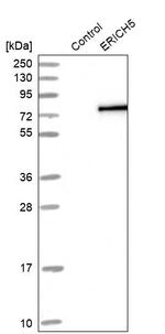 ERICH5 Antibody in Western Blot (WB)