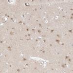 FBXO42 Antibody in Immunohistochemistry (Paraffin) (IHC (P))