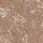 FBXO42 Antibody in Immunohistochemistry (Paraffin) (IHC (P))