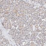 FBXO42 Antibody in Immunohistochemistry (Paraffin) (IHC (P))
