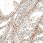 FBXO42 Antibody in Immunohistochemistry (Paraffin) (IHC (P))