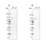 MAN1 Antibody in Western Blot (WB)