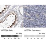 ACTRT2 Antibody in Immunohistochemistry (IHC)
