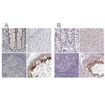 ACTRT2 Polyclonal Antibody