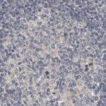 ACTRT2 Antibody in Immunohistochemistry (IHC)