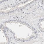 SDR16C5 Antibody in Immunohistochemistry (Paraffin) (IHC (P))