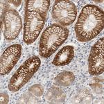 SDR16C5 Antibody in Immunohistochemistry (Paraffin) (IHC (P))