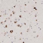 GGH Antibody in Immunohistochemistry (Paraffin) (IHC (P))