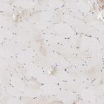 GGH Antibody in Immunohistochemistry (Paraffin) (IHC (P))