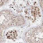 GGH Antibody in Immunohistochemistry (Paraffin) (IHC (P))