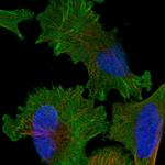 KNTC1 Polyclonal Antibody