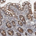 KNTC1 Antibody in Immunohistochemistry (Paraffin) (IHC (P))
