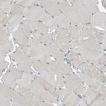 KNTC1 Antibody in Immunohistochemistry (Paraffin) (IHC (P))