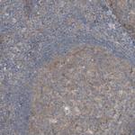 KNTC1 Antibody in Immunohistochemistry (Paraffin) (IHC (P))