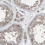 KNTC1 Antibody in Immunohistochemistry (IHC)