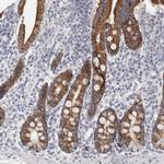 FBLIM1 Polyclonal Antibody