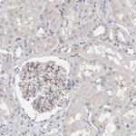 FBLIM1 Antibody in Immunohistochemistry (Paraffin) (IHC (P))