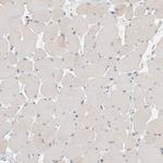 FBLIM1 Antibody in Immunohistochemistry (Paraffin) (IHC (P))