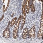 FBLIM1 Antibody in Immunohistochemistry (IHC)