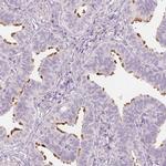 ERICH5 Antibody in Immunohistochemistry (IHC)