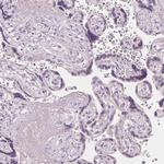 ERICH5 Antibody in Immunohistochemistry (IHC)