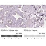 ERICH5 Antibody