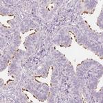 ERICH5 Polyclonal Antibody
