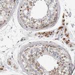 RBM48 Antibody in Immunohistochemistry (IHC)