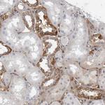 RBM48 Antibody in Immunohistochemistry (IHC)