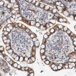 RBM48 Antibody in Immunohistochemistry (IHC)
