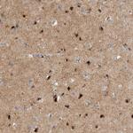 RBM48 Antibody in Immunohistochemistry (IHC)