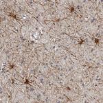 ADCK5 Antibody in Immunohistochemistry (Paraffin) (IHC (P))