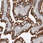 PCMTD1 Polyclonal Antibody