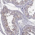 SPDYE4 Antibody in Immunohistochemistry (IHC)
