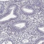 SPDYE4 Antibody in Immunohistochemistry (IHC)