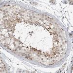 KIAA1731NL Antibody in Immunohistochemistry (Paraffin) (IHC (P))