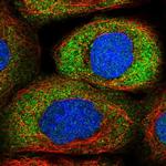 NRARP Polyclonal Antibody