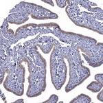 NRARP Antibody in Immunohistochemistry (Paraffin) (IHC (P))
