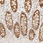 NRARP Antibody in Immunohistochemistry (IHC)