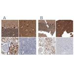 ACOT7 Antibody in Immunohistochemistry (IHC)