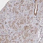 EDEM3 Polyclonal Antibody