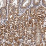 EDEM3 Antibody in Immunohistochemistry (IHC)