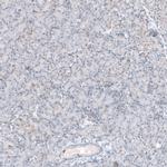 ACOT7 Antibody in Immunohistochemistry (IHC)