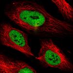 PHF3 Polyclonal Antibody