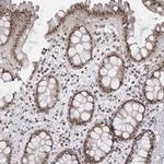 PHF3 Antibody in Immunohistochemistry (Paraffin) (IHC (P))