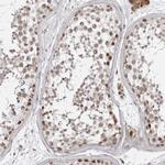 PHF3 Antibody in Immunohistochemistry (Paraffin) (IHC (P))