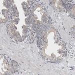 TMEM242 Antibody in Immunohistochemistry (Paraffin) (IHC (P))
