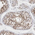 TMEM242 Polyclonal Antibody