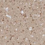 TMEM242 Antibody in Immunohistochemistry (IHC)