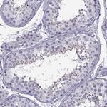 ARMC2 Antibody in Immunohistochemistry (IHC)